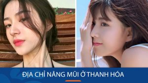 Địa chỉ nâng mũi ở Thanh Hóa chuẩn Hàn Quốc!