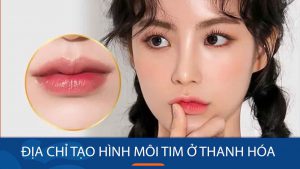 Địa chỉ tạo hình môi tim ở Thanh Hóa đảm bảo uy tín