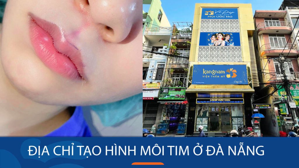 Địa chỉ tạo hình môi tim ở Đà Nẵng – Tạo môi tim quyến rũ