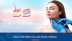 Địa chỉ tiêm filler ở Đà Nẵng uy tín, nhiều review nhất