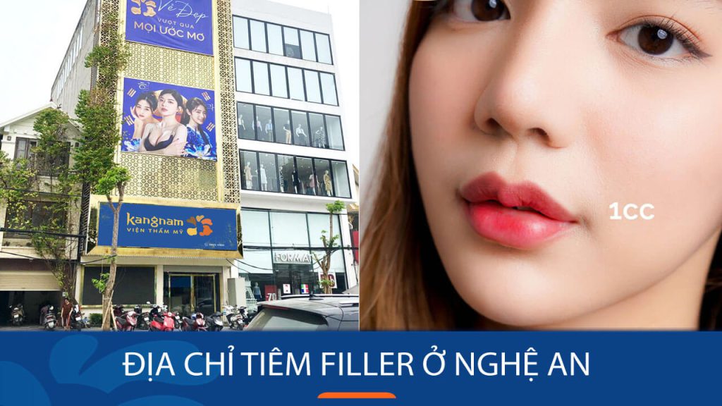 Địa chỉ tiêm filler ở Nghệ An đẹp tự nhiên, mềm mại