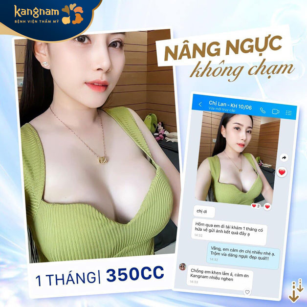 100% khách hàng hài lòng khi nâng ngực tại Kangnam