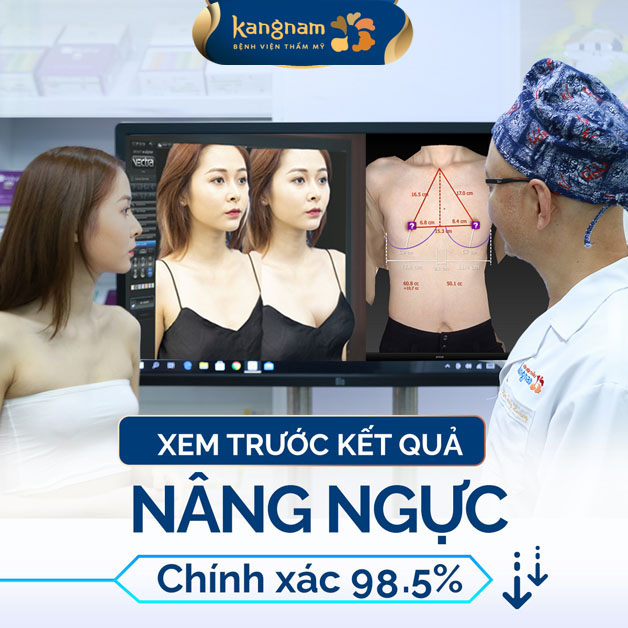 Nâng ngực tại Kangnam uy tín, chính xác 98,5%