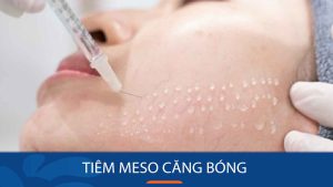 Tiêm meso căng bóng da mặt – Bí quyết trẻ hóa da hiệu quả