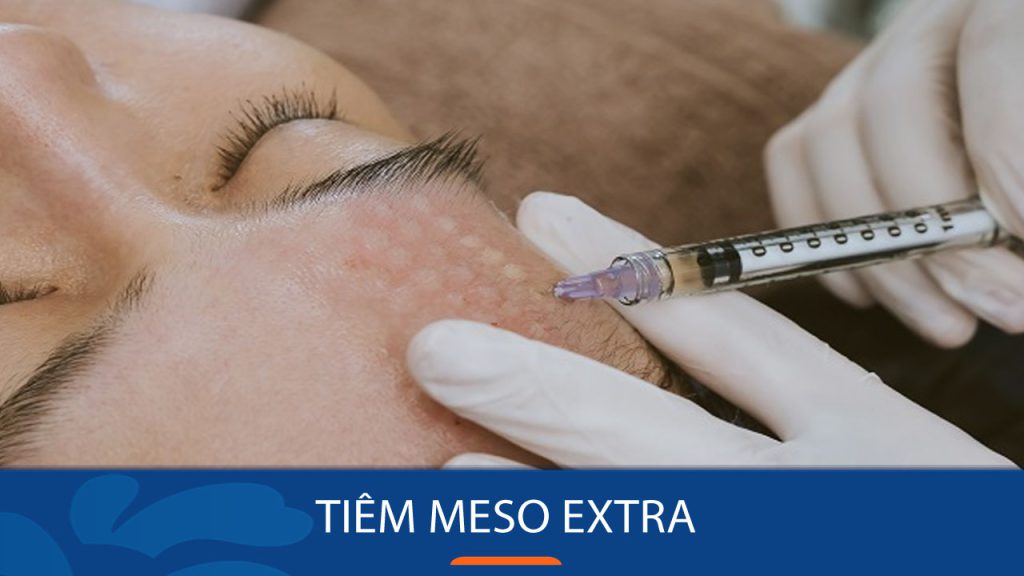 Tiêm Meso Extra – Bí quyết trẻ hóa da không phẫu thuật