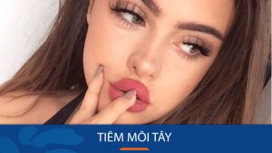 Tiêm môi tây – Bí quyết sở hữu bờ môi quyến rũ chuẩn Tây