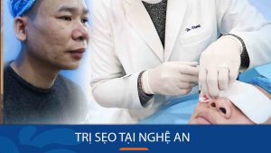 Địa chỉ Trị sẹo uy tín tại Nghệ An: được nhiều người đánh giá cao