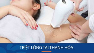 Địa chỉ Triệt lông tại Thanh Hóa chuyên nghiệp, uy tín nhất