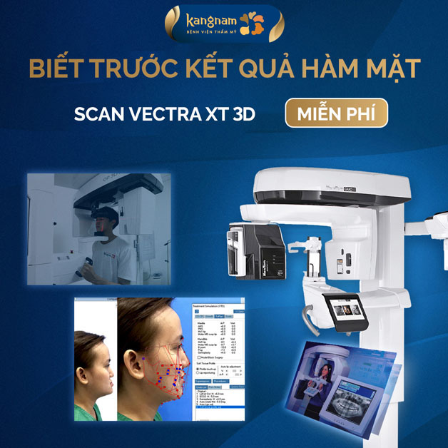 Công nghệ Scan Vectra XT 3D hiện đại phục vụ phẫu thuật hàm mặt