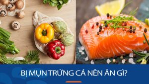 Bị mụn trứng cá nên ăn gì? Chế độ ăn uống chuẩn cho da mụn: Nhanh đẹp không tì vết