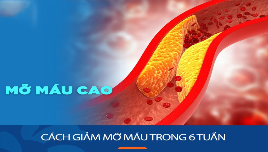 Mách bạn những cách giảm mỡ máu trong 6 tuần an toàn