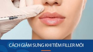 9 Bí quyết “VÀNG” Giúp Giảm Sưng Môi Hiệu Quả Sau Khi Tiêm Filler