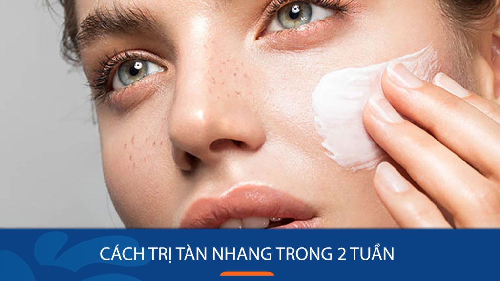 8 Cách trị tàn nhang trong 2 tuần và một số lưu ý quan trọng