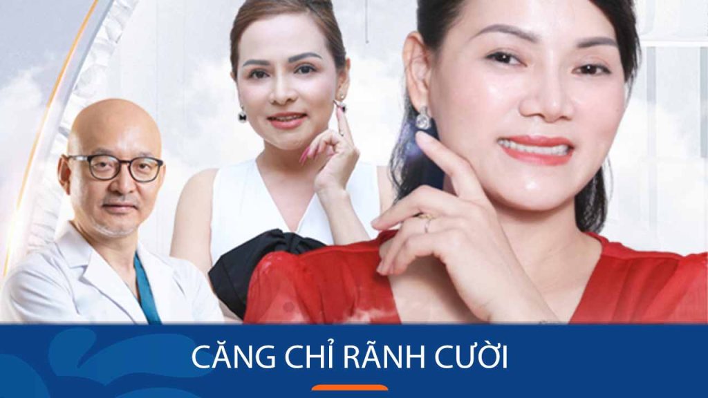Căng chỉ rãnh cười: Bí quyết xóa nếp nhăn, trẻ hóa da [Nhanh chóng – Hiệu quả – An toàn]