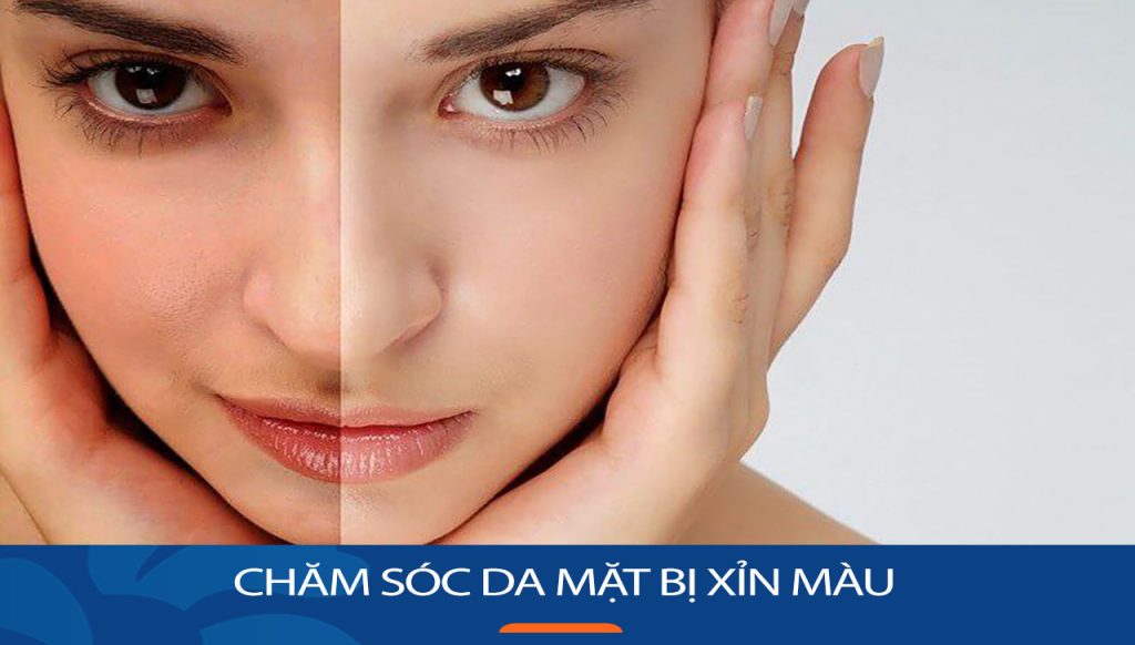 7 Bước quan trọng chăm sóc da mặt bị xỉn màu không thể thiếu