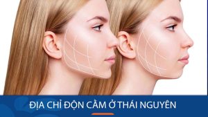 Địa chỉ độn cằm ở Thái Nguyên – Uy Tin- Chất lượng