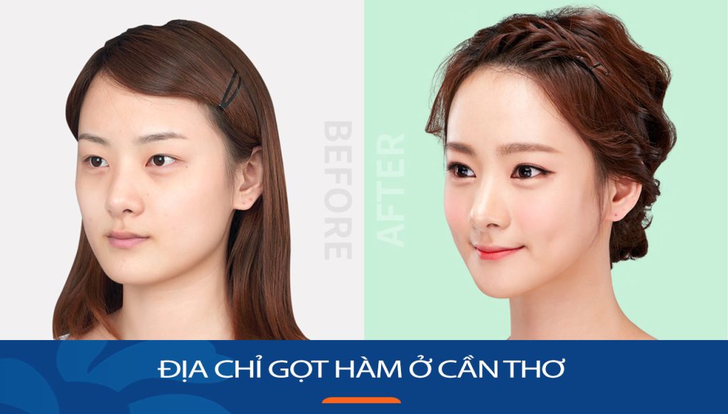 Viện thẩm mỹ Kangnam – Địa chỉ gọt hàm ở Cần Thơ Uy tín