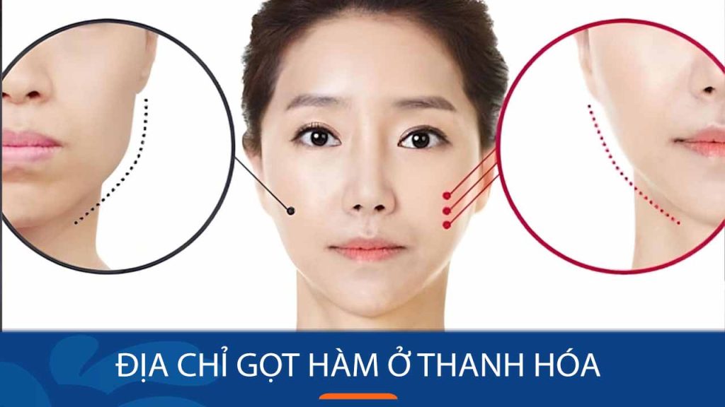Địa chỉ gọt hàm ở Thanh Hóa uy tín – Tin cậy
