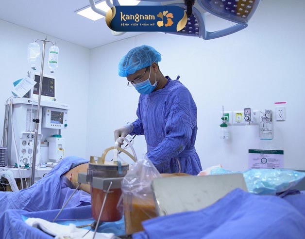 Quy trình hút mỡ chuẩn Y khoa tại Kangnam