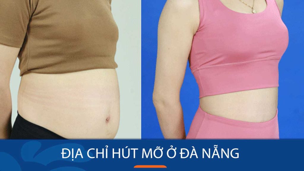 Kangnam Địa chỉ Hút mỡ ở Đà Nẵng Nổi Tiếng An Toàn