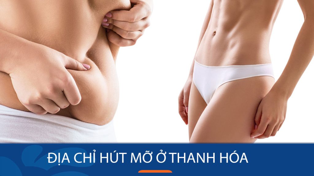 Địa chỉ hút mỡ ở Thanh Hóa – eo thon – dáng đẹp và an toàn!