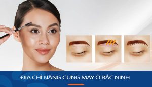 Địa chỉ nâng cung mày ở Bắc Ninh đẹp và giá cả phải chăng