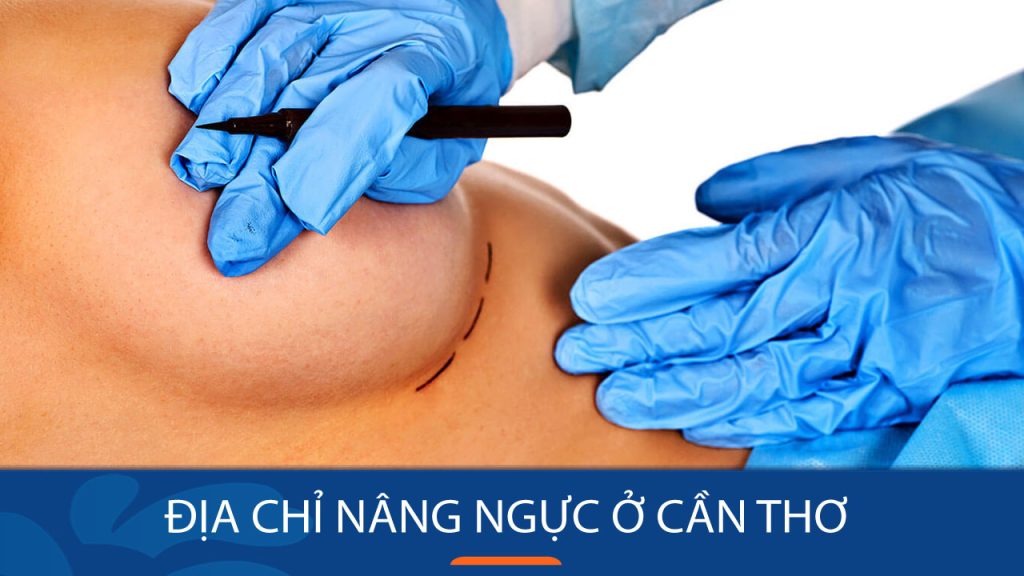 Địa chỉ nâng ngực tại Cần Thơ – Công nghệ hiện đại cho vòng 1 hoàn hảo
