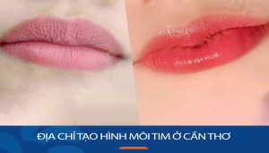 Địa chỉ Tạo hình môi tim ở Cần Thơ uy tín – Kangnam