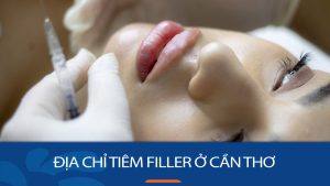 Địa chỉ tiêm filler ở Cần Thơ – Filler xịn, kết quả tự nhiên, an toàn