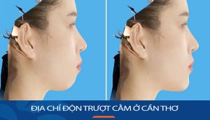 Địa chỉ Trượt cằm ở Cần Thơ đẹp và tự nhiên nhất