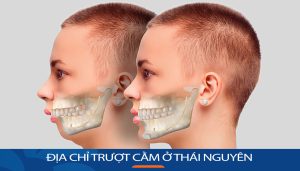 Địa chỉ Trượt cằm ở Thái Nguyên đẹp tự nhiên và an toàn