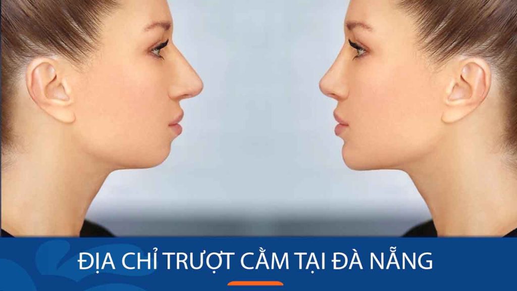 Địa chỉ Trượt cằm ở Đà Nẵng – Uy Tín – An Toàn