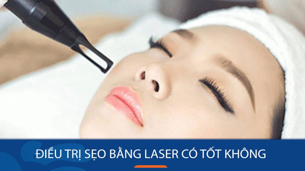 Điều trị sẹo rỗ bằng laser có tốt không? Nên hay không nên điều trị sẹo rỗ bằng laser?
