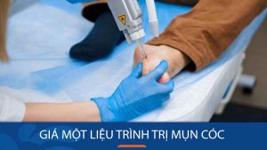 So sánh giá trị liệu mụn cóc: Tìm hiểu phương án tốt nhất cho bạn