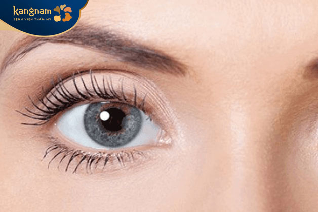 Mắt xám chiếm khoảng 3% trong tổng số dân số trên thế giới