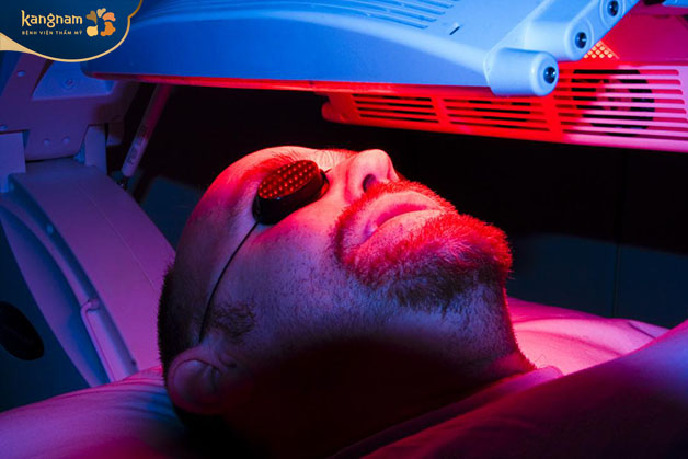 Liệu pháp quang động kết hợp laser giúp điều trị mụn nang hiệu quả 