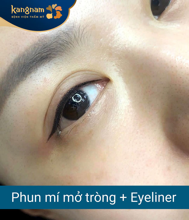 Khách hàng phun mí mở tròng kết hợp eyeliner giúp mắt trông to hơn
