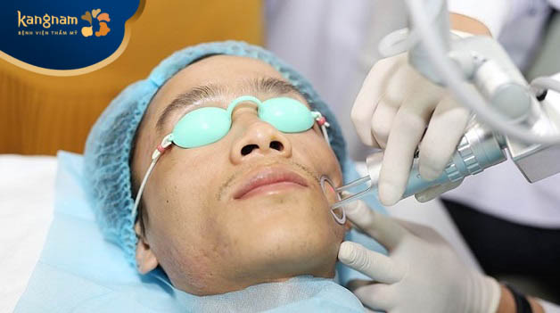 Công nghệ Laser CO2 trị sẹo rỗ hiệu quả