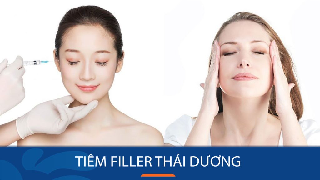 Tiêm filler thái dương tạo khuôn mặt trẻ trung, cân đối