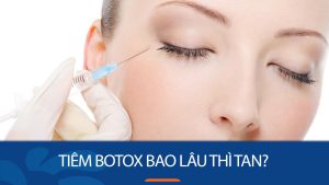 Tiêm botox bao lâu tan? Giải đáp chi tiết từ chuyên gia
