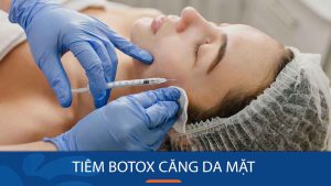 Tiêm botox căng da mặt: Bí quyết trẻ hóa da nhanh chóng