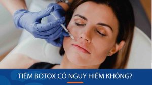 Tiêm botox có nguy hiểm không? Giải đáp mọi thắc mắc