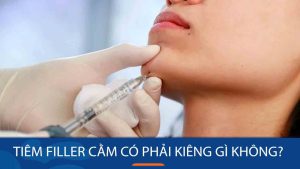 Tiêm filler cằm có phải kiêng gì không? Lưu ý cần nhớ để có kết quả như ý