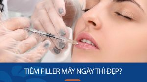 Tiêm filler bao lâu thì đẹp? Giải đáp thắc mắc cho người mới bắt đầu