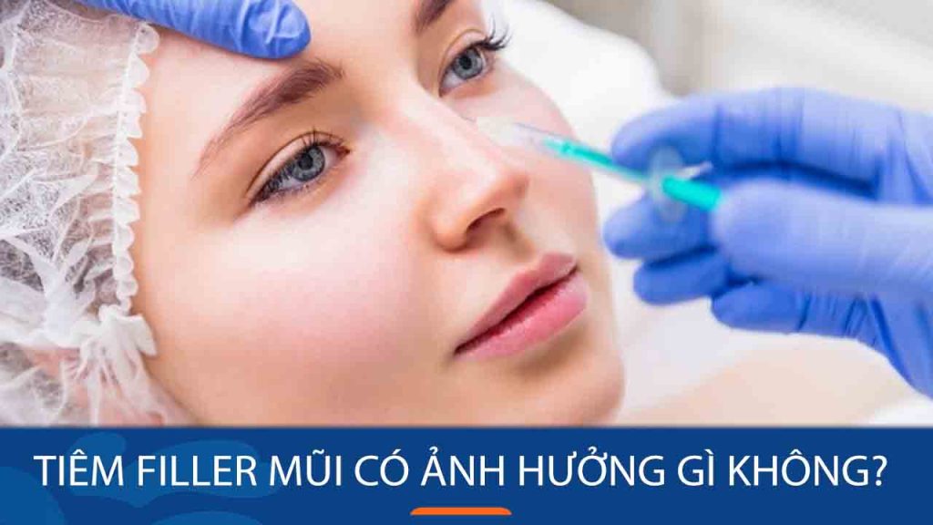 Tiêm filler mũi có ảnh hưởng gì không? Cần lưu ý gì trước, trong và sau khi tiêm filler mũi?