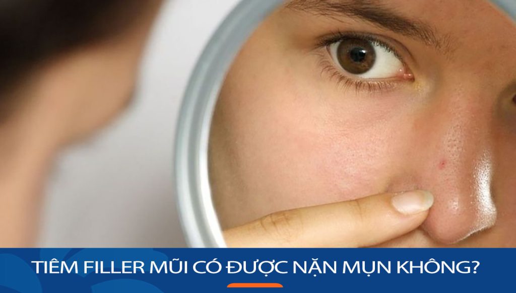 Tiêm filler mũi có được nặn mụn không? Nguy cơ tiềm ẩn và cách xử lý hiệu quả