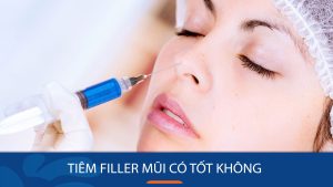 Tiêm filler mũi có tốt không? có an toàn không