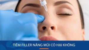 Tiêm filler nâng mũi có hại không? Nâng mũi đẹp tự nhiên với tiêm filler