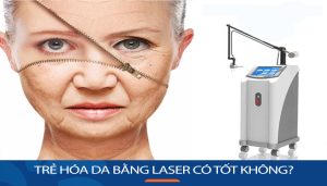 Trẻ hóa da bằng laser có tốt không? Phương pháp Laser phổ biến