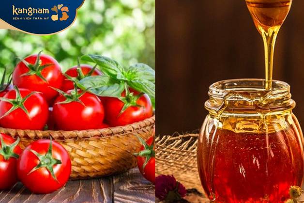 Cách điều trị nám tại nhà bằng mật ong và cà chua